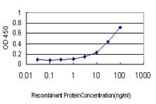 CFL2 / Cofilin 2 Antibody (clone 6G9)