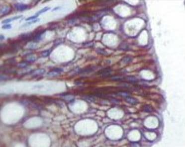 IGF1R / IGF1 Receptor Antibody (clone 3C8B1)