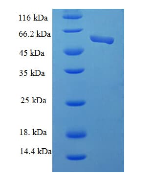 Human CSNK2A2 Protein (Recombinant His-SUMO)