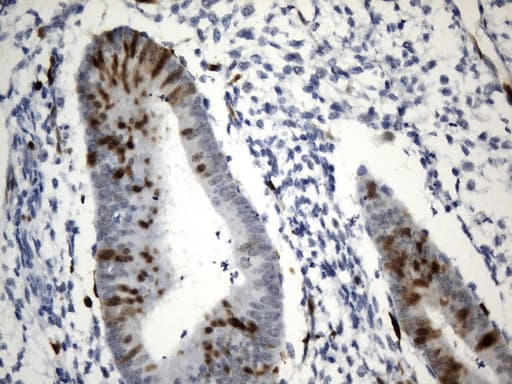 TS / Thymidylate Synthase Antibody (clone UMAB227)