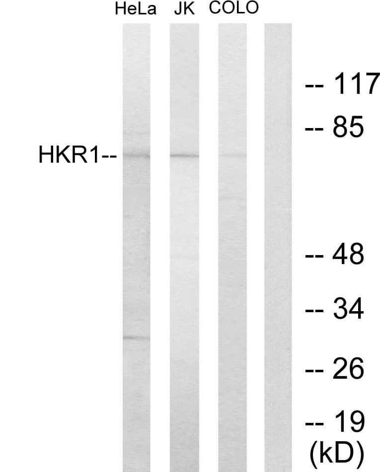 Polyclonal Rabbit anti-Human HKR1 Antibody (aa141-190, IF, WB)