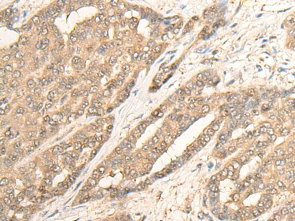 IMPA1 / IMP Antibody