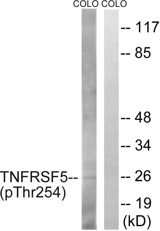 CD40 Antibody (phospho-Thr254)