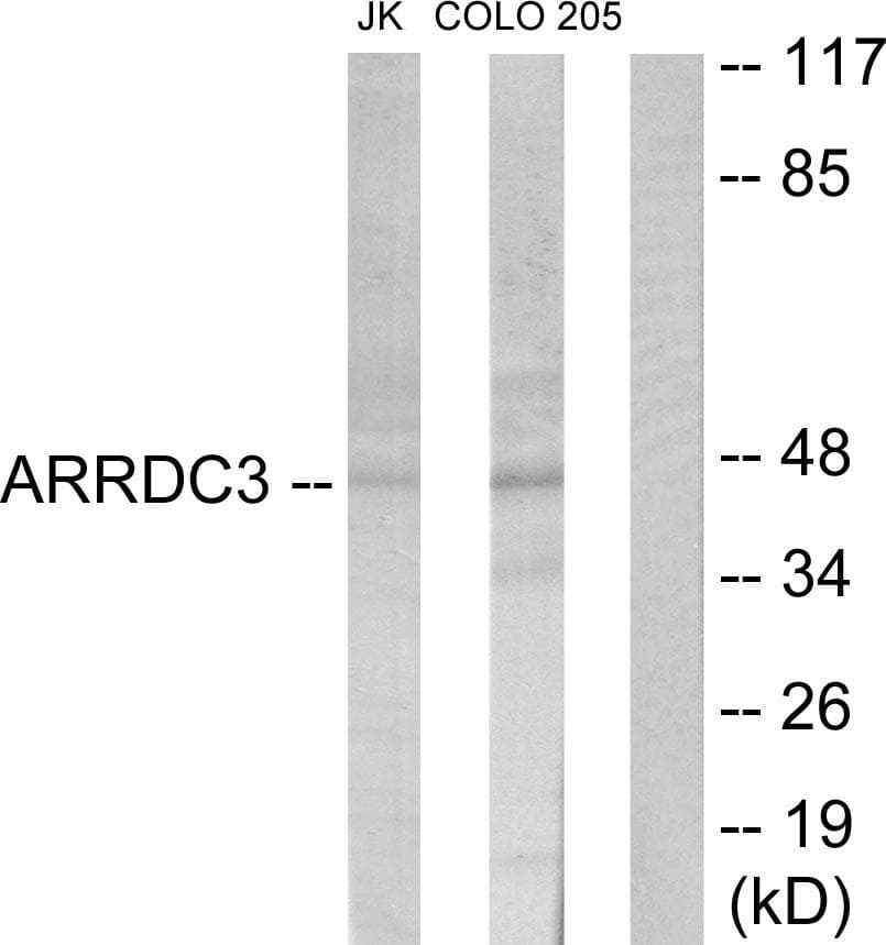 Polyclonal Rabbit anti-Human ARRDC3 Antibody (WB)