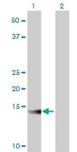 ATP6V1G2 Antibody (clone 2E11)