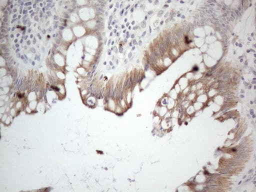 Monoclonal Mouse anti-Human HGF / Hepatocyte Growth Factor Antibody (clone OTI1D2, aa200-494, IHC, WB)