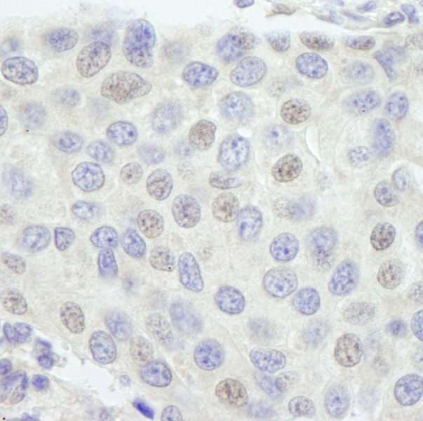 GTF3C1 Antibody (aa1475-1525)