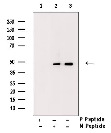Polyclonal Rabbit anti-Human IKBKG / NEMO / IKK Gamma Antibody (phospho-Ser85, IF, WB)