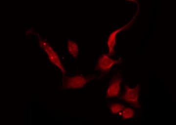 Polyclonal Rabbit anti-Human GNAT2 Antibody (IF, WB)