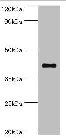 SULT2B1 / Sulfotransferase 2B1 Antibody (aa1-365)