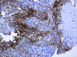 KRT5 / CK5 / Cytokeratin 5 Antibody (aa1-273, clone OTI1E7)