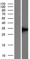 UCP1 / UCP-1 Protein (Over-Expression Lysate Myc-DDK (Flag))