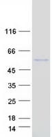Human PLA2G15 / ACS Protein (Recombinant Myc-DDK (Flag))