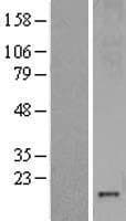 Human MT3 / Metallothionein 3 Protein (Over-Expression Lysate Myc-DDK (Flag))