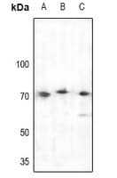 BTK Antibody
