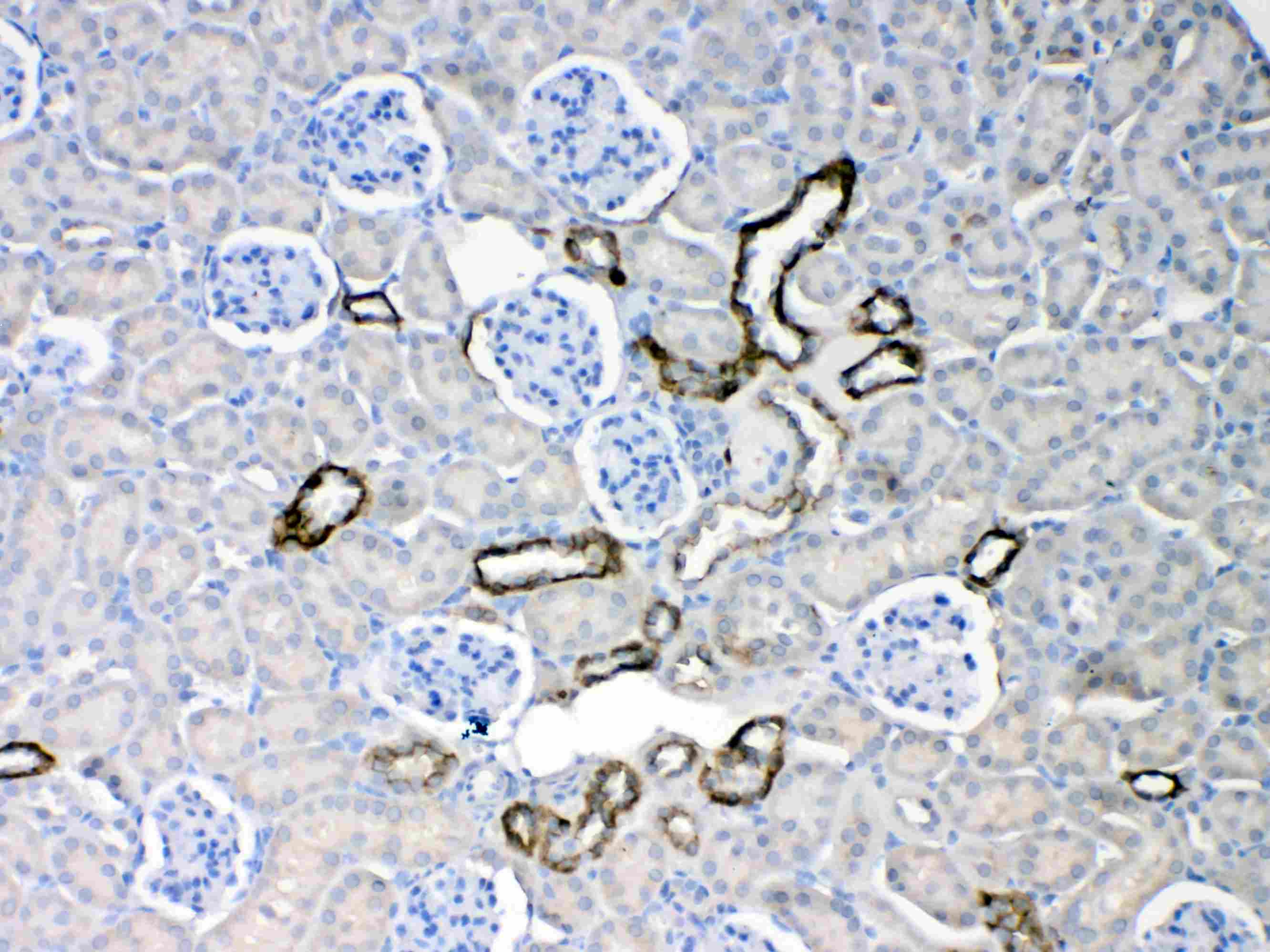 KRT18 / CK18 / Cytokeratin 18 Antibody