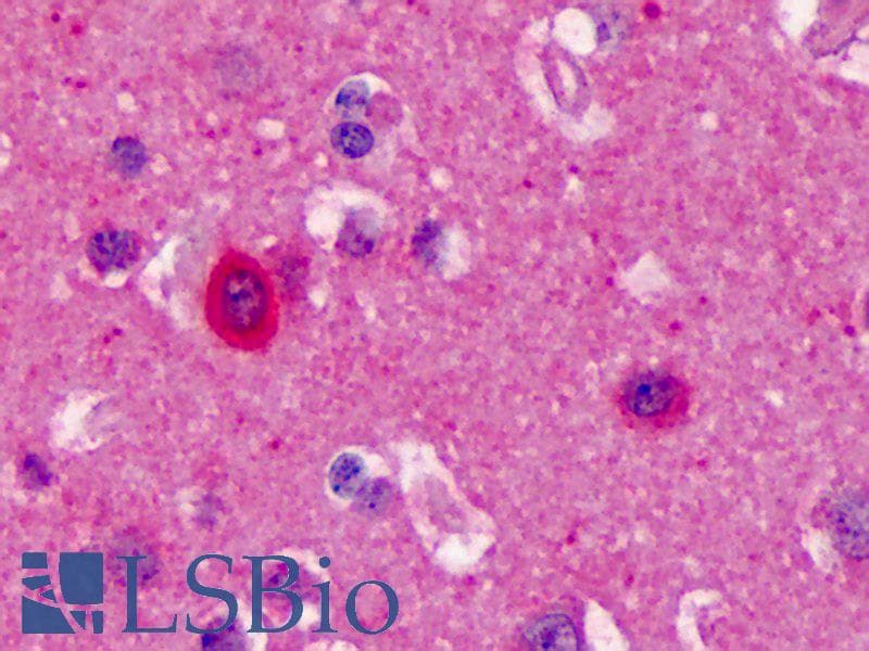 PathPlus™ NOS1 / nNOS Antibody (aa1422-1433)