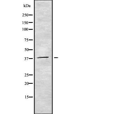 Polyclonal Rabbit anti-Human CDC123 Antibody (WB)