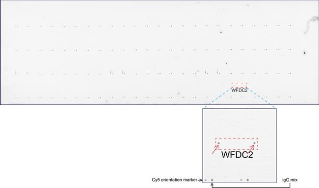 WFDC2 / HE4 Antibody (aa31-124, clone UMAB88)