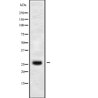 CLDN14 / Claudin 14 Antibody