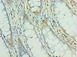 Polyclonal Rabbit anti-Human MEF2C Antibody (aa170-380, IHC)