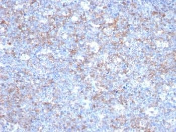 MCAM / CD146 Antibody (clone C146/634)