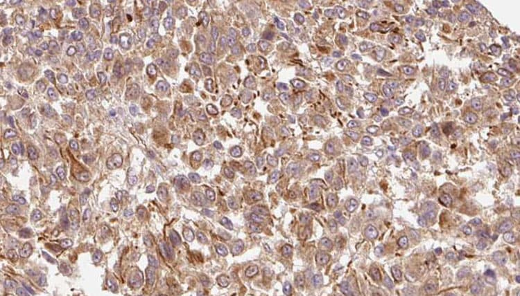 BGN / Biglycan Antibody