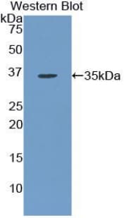 KDR / VEGFR2 / FLK1 Antibody (aa46-322, Biotin)