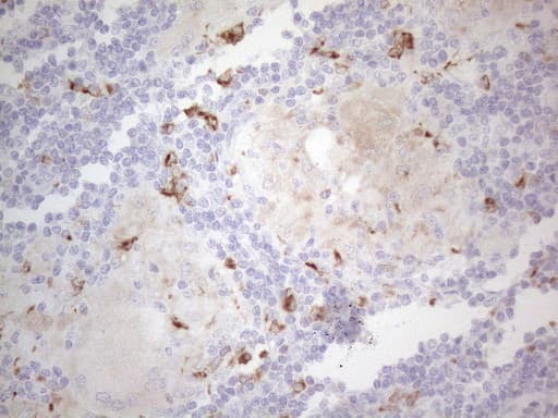 APOBR / APOB48R Antibody (aa780-1088, clone OTI1B5)