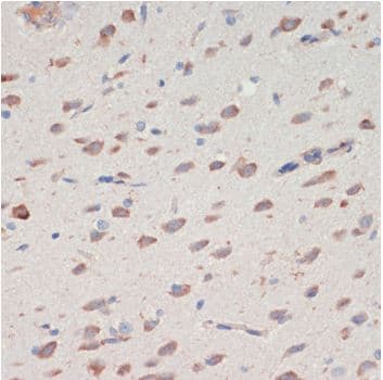 Neuroserpin Antibody (aa181-410)