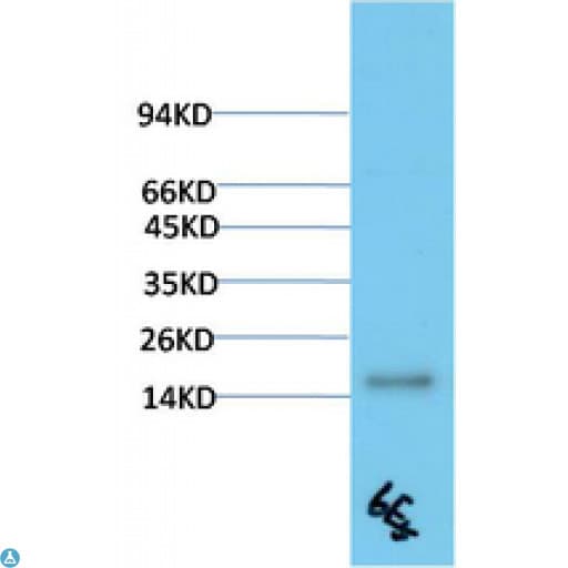 TTR / Transthyretin Antibody
