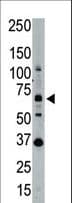 IHC-plus™ Polyclonal Rabbit anti-Human SENP1 Antibody (aa28-59, IHC, WB)