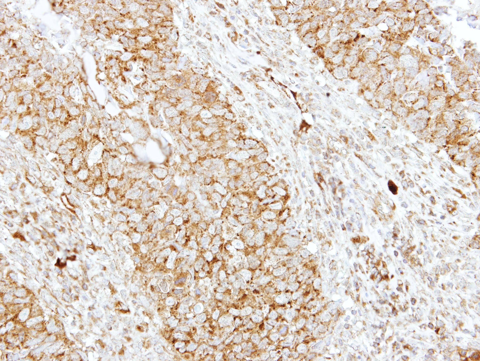SH3GL1 / EEN Antibody (aa152-368)