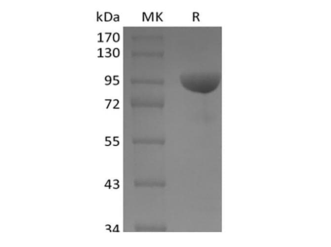 Human EPHB1 / EPH Receptor B1 Protein (Recombinant Fc, C-terminus)