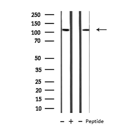 Polyclonal Rabbit anti-Human MBTPS1 / S1P Antibody (IHC, IF, WB)