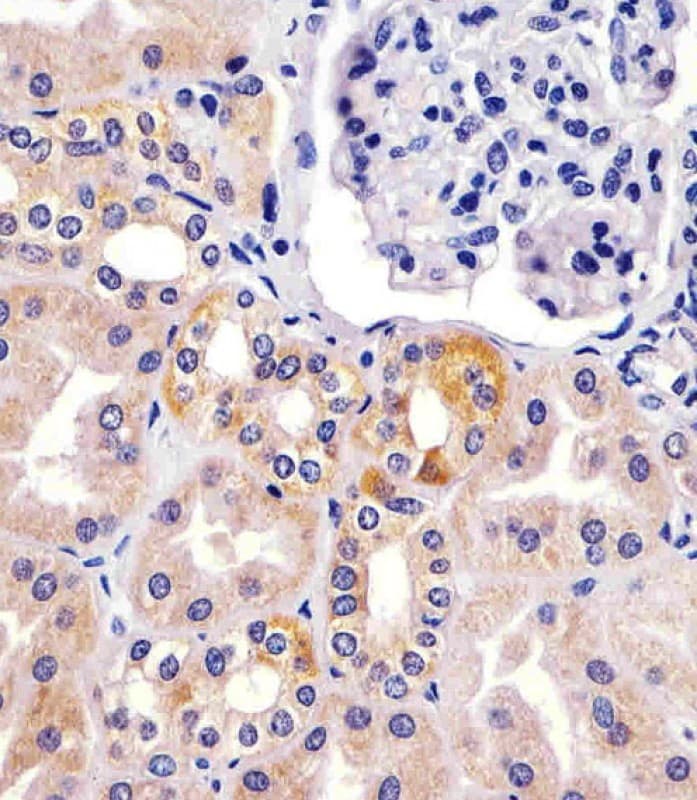 TIMP2 Antibody (clone 1554CT494.262.47)