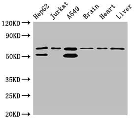 Polyclonal Rabbit anti-Human SNX27 Antibody (IHC, WB)