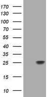Monoclonal Mouse anti-Human TCL / RHOJ Antibody (clone OTI5F5, IHC, WB)