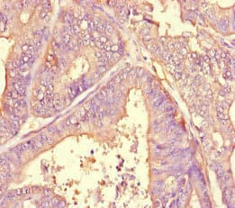 A2M / Alpha-2-Macroglobulin Antibody
