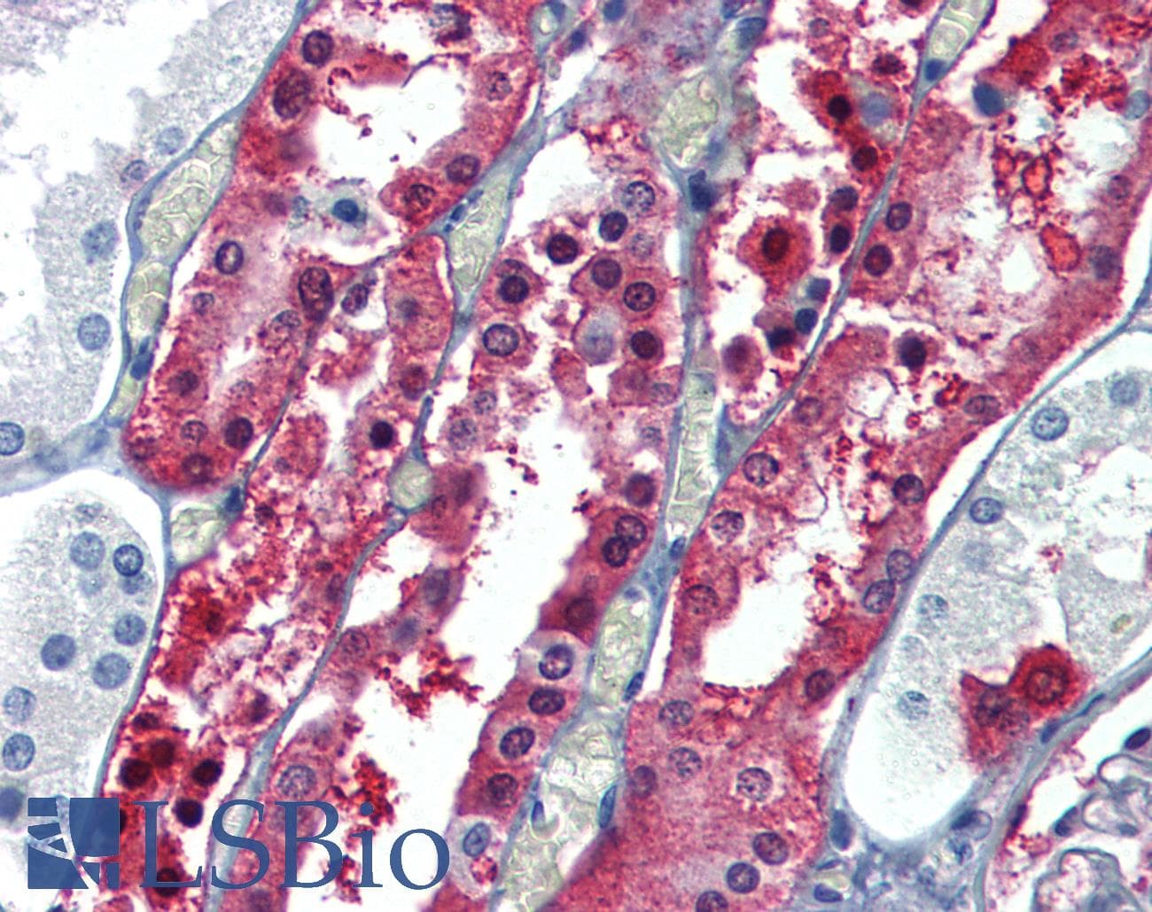 IHC-plus™ GSTP1 / GST Pi Antibody
