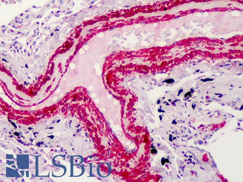 PathPlus™ Polyclonal Rabbit anti-Human ACTA2 / Smooth Muscle Actin Antibody (N-Terminus, IHC)