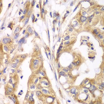 Polyclonal Rabbit anti-Human TXNRD2 Antibody (IHC, WB)