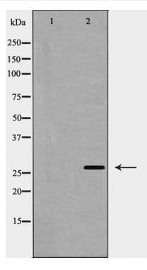CAV2 / Caveolin 2 Antibody