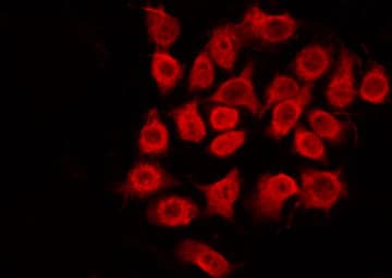 SS18 Antibody