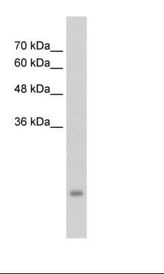 PSG3 Antibody (aa101-150)