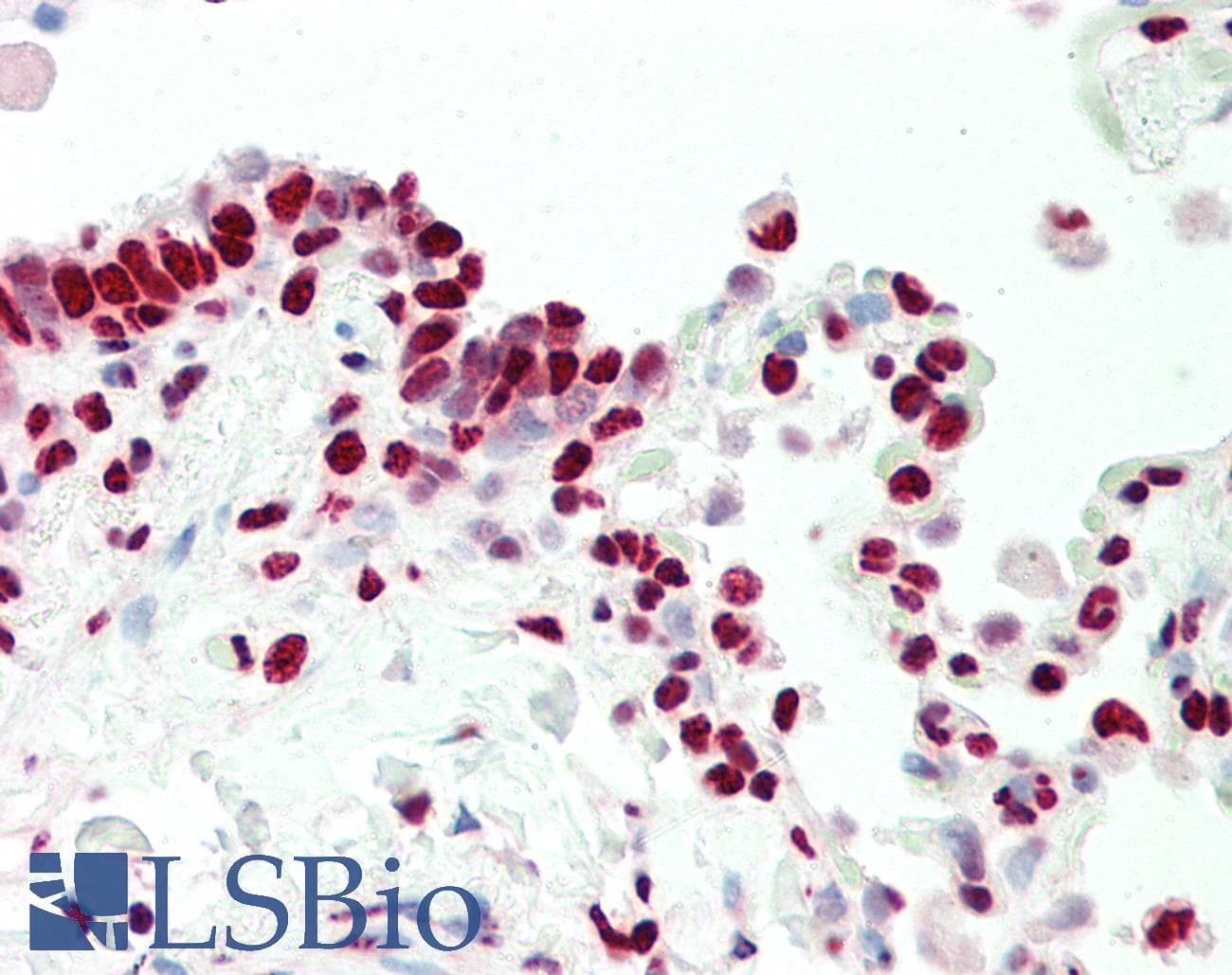 EAR2 / NR2F6 Antibody (N-Terminus)