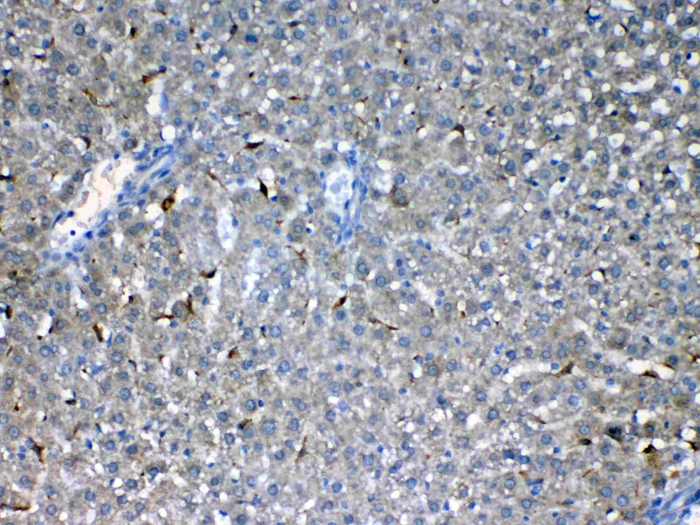Polyclonal Rabbit anti-Mouse CD135 / FLT3 Antibody (IHC, WB)