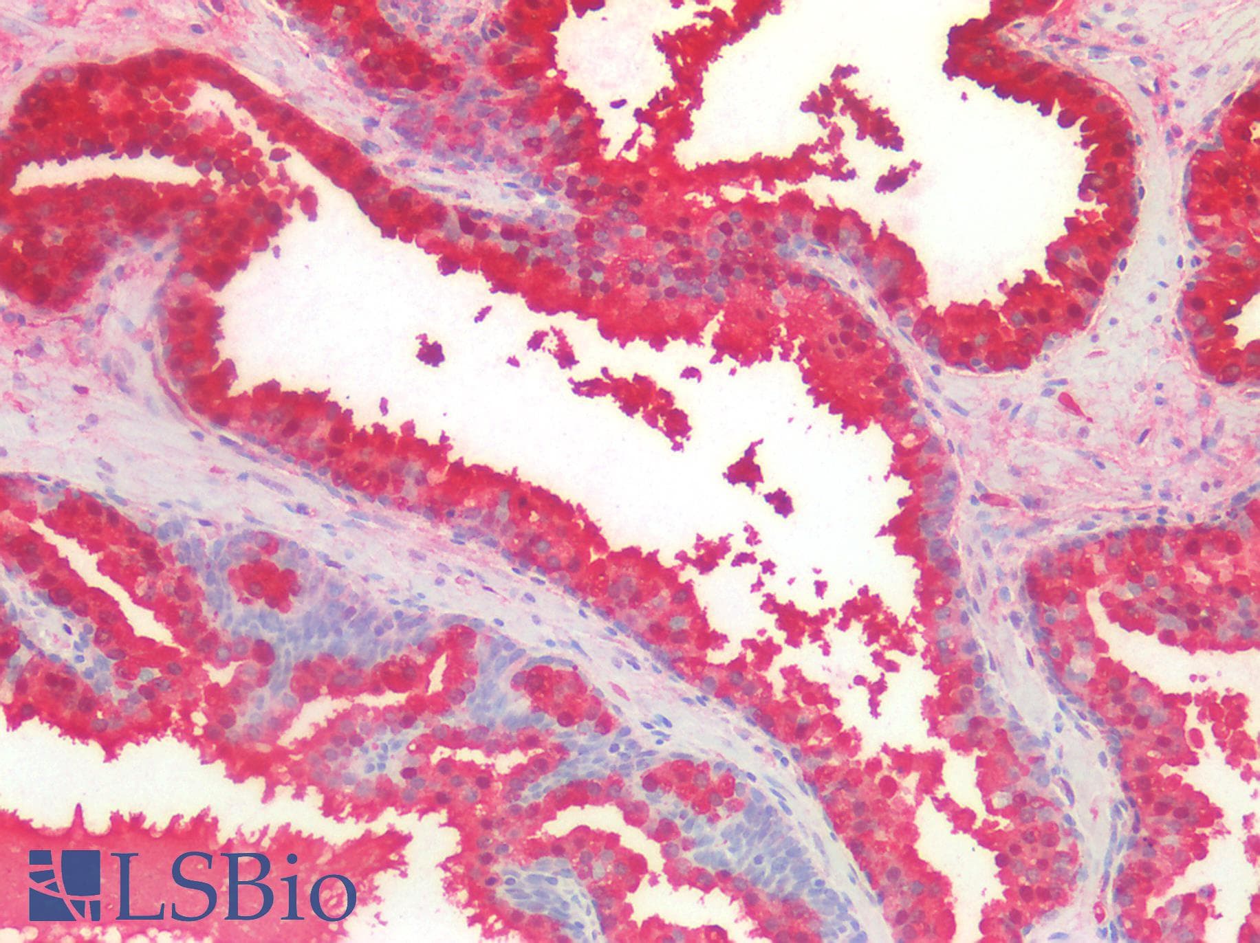MSMB / MSP Antibody (clone OTI6C7, Carrier-free)