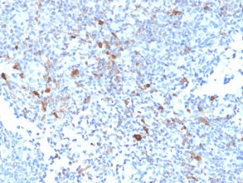 TRAF1 Antibody (clone TRAF1/2770, Ready-to-Use)