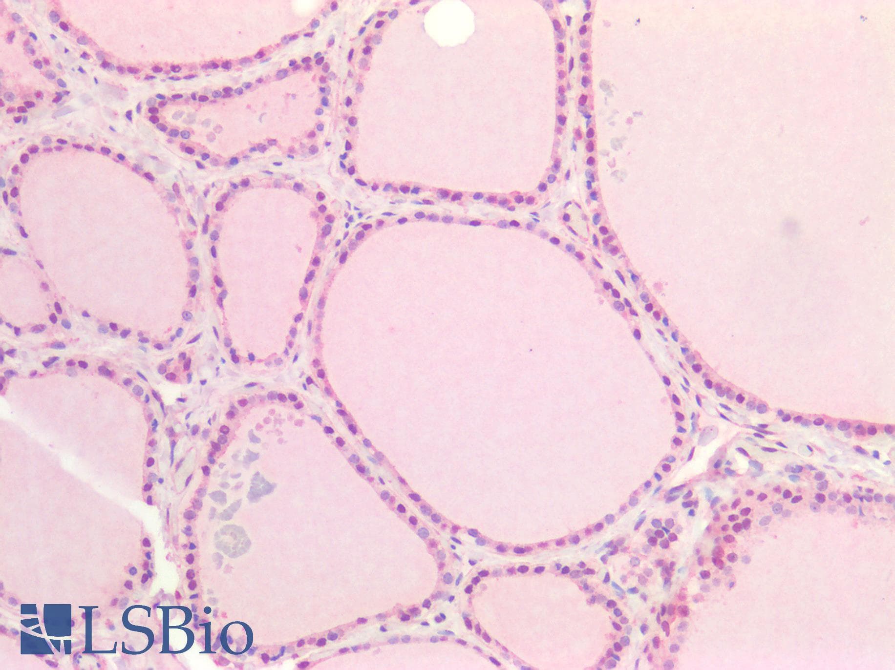 IHC-plus™ CD118 / LIF Receptor Alpha Antibody